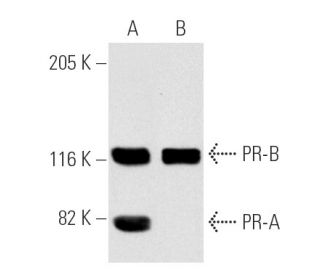 Progesterone Receptor Antibody (B-30) - Western Blotting - Image 1753