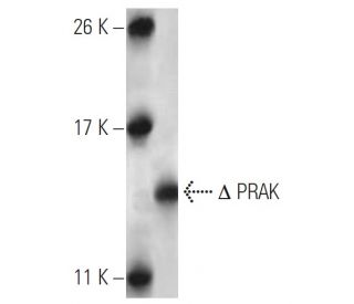 PRAK Antibody (7H10B4) - Western Blotting - Image 137447