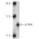 PRAK Antibody (7H10B4) - Western Blotting - Image 137447
