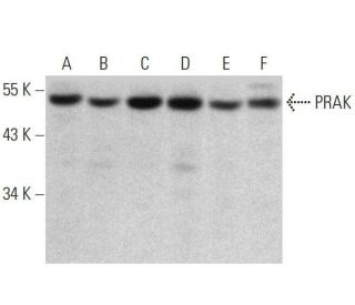 PRAK Antibody (A-7) - Western Blotting - Image 358731Each CRISPR/Cas9 Knockout (KO) Plasmid product consists of a pool of 3 plasmids designed to ensure identification and cleavage of a specific gene for maximum knockout efficiency. Each plasmid encodes a unique 20 nt sequence derived from the GeCKO (v2) library.