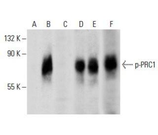 PRC1 Antibody (6G2) - Western Blotting - Image 288020