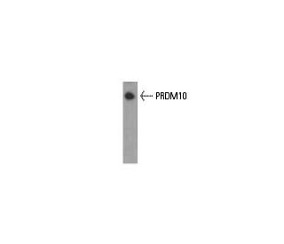 PRDM10 Antibody (48AT1224.90.46) - Western Blotting - Image 37814