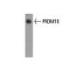 PRDM10 Antibody (48AT1224.90.46) - Western Blotting - Image 37814