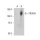PRDM4 Antibody (A-10) - Western Blotting - Image 401191