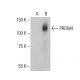 PRDM4 Antibody (A-10) - Western Blotting - Image 401192 