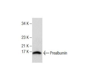 Prealbumin Antibody (E-1) - Western Blotting - Image 158356