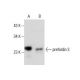 prefoldin 3 Antibody (B-3) - Western Blotting - Image 288609