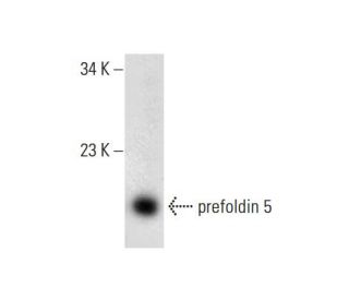 prefoldin 5 Antibody (G-2) - Western Blotting - Image 132745 