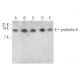 prefoldin 6 Antibody (F-11) - Western Blotting - Image 371249
