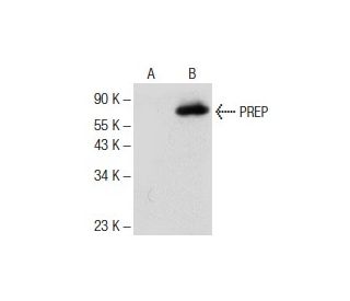 PREP Antibody (C-12) - Western Blotting - Image 141298