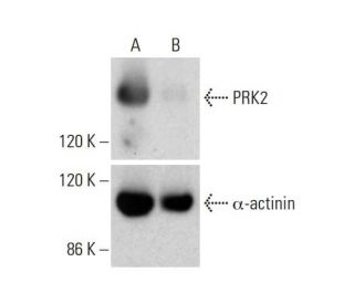 PRK2 CRISPR/CAS9 KO Plasmid (h): sc-407649. Western blot analysis of PRK2 expression in empty vector control (A) and PRK2 