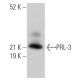 PRL-3 Antibody (318) - Western Blotting - Image 363566