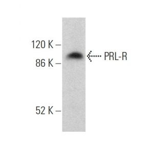 PRL-R Antibody (B10) - Western Blotting - Image 359660The Double Nickase Plasmid features a U6 promoter for sgRNA expression, a 20 nt targeting sequence, and a gRNA scaffold to guide Cas9n. It includes a CBh promoter for Cas9n (D10A) and puromycin resistance, GFP for transfection verification, and nuclear localization signals (NLS). The 2A peptide allows co-expression of Cas9n and Puro from a single promoter, enabling precise genome editing with reduced off-target effects.