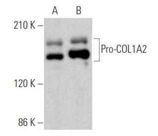 Pro-COL1A2 Antibody (D-6) - Western Blotting - Image 369268 