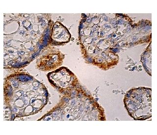 Pro-COL3A1 Antibody (B-4) - Immunohistochemistry - Image 158890 