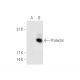 Prolactin Antibody (E-9) - Western Blotting - Image 62739 