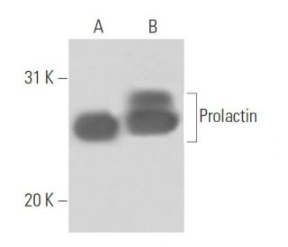 Prolactin Antibody (PRL-151) - Western Blotting - Image 15684 