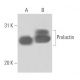 Prolactin Antibody (PRL-151) - Western Blotting - Image 15684 