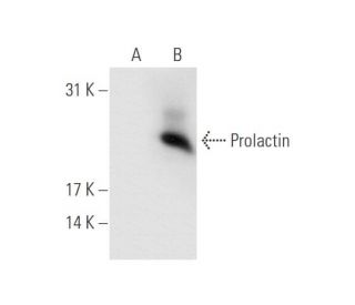 Prolactin (PRL-149L II): sc-69874. Western blot analysis of Prolactin expression... 