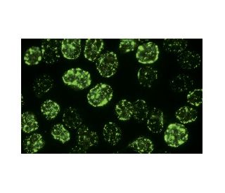 Proliferation Marker Antibody (JC1) - Immunofluorescence - Image 15922