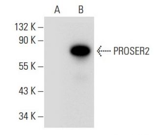 PROSER2 Antibody (G-11) - Western Blotting - Image 314489