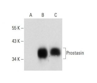 Prostasin Antibody (2) - Western Blotting - Image 144905 