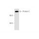 Protein C Antibody (GMA-067) - Western Blotting - Image 67938