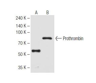 Prothrombin Antibody (28H5) - Western Blotting - Image 62817 