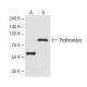 Prothrombin Antibody (28H5) - Western Blotting - Image 62817 