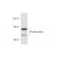 Prothrombin Antibody (AHP-5013) - Western Blotting - Image 57743 