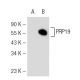 PRP19 Antibody (36-K) - Western Blotting - Image 60002