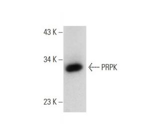 PRPK Antibody (B-7) - Western Blotting - Image 324737