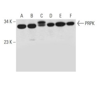 PRPK Antibody (C-1) - Western Blotting - Image 326523 