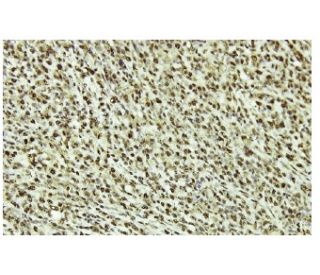 PRPK Antibody (F-9) - Immunohistochemistry - Image 35984 