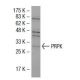 PRPK Antibody (F-9) - Western Blotting - Image 33726 