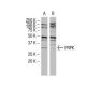 PRPK Antibody (F-9) - Western Blotting - Image 33727