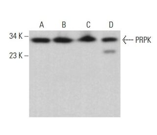 PRPK Antibody (G-10) - Western Blotting - Image 378150 