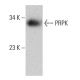 PRPK Antibody (G-10) - Western Blotting - Image 387339