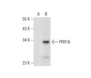 PRR18 Antibody (G-6) - Western Blotting - Image 305857