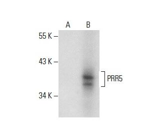 PRR5 Antibody (A-7) - Western Blotting - Image 288631