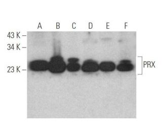 PRX Antibody (B-11) - Western Blotting - Image 352472 