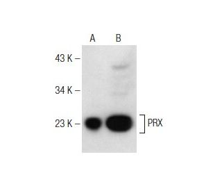 PRX Antibody (H-6) - Western Blotting - Image 147279 