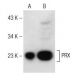 PRX Antibody (H-6) - Western Blotting - Image 147279 