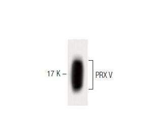 PRX V Antibody (44) - Western Blotting - Image 60422 