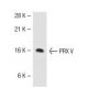 PRX V Antibody (B-7) - Western Blotting - Image 40018