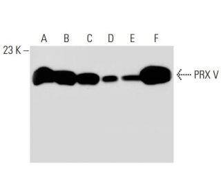 PRX V Antibody (H-5) - Western Blotting - Image 30498 