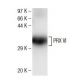 PRX VI Antibody (36) - Western Blotting - Image 136738