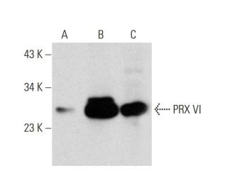 PRX VI Antibody (36) - Western Blotting - Image 144598 
