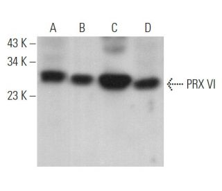 PRX VI Antibody (36) - Western Blotting - Image 363445 