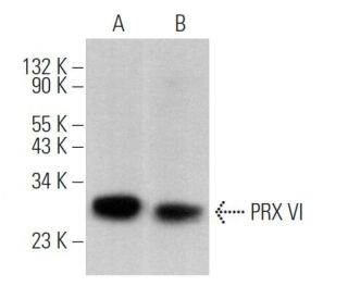 PRX VI Antibody (36) - Western Blotting - Image 363446 